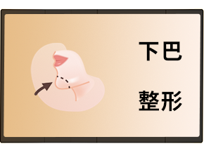 下巴整形-上海娜美下巴整形